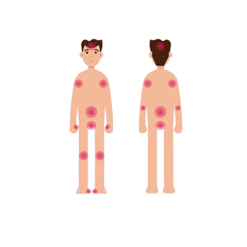 Dermatólogo especialista en Psoriasis | Tratamiento integral | 360º